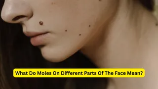What Does A Mole On Your Face Symbolise? Meanings Of Different Mole Placements