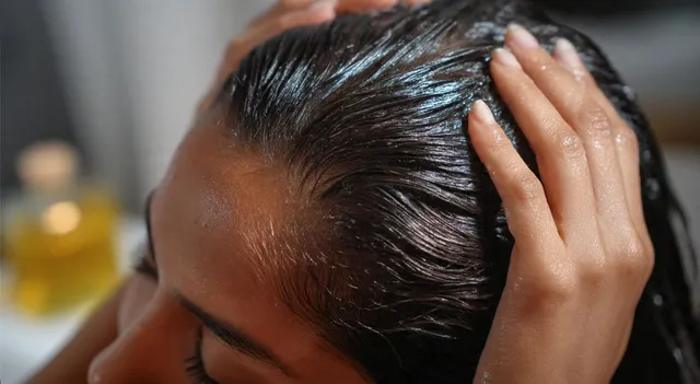 hair-oils-that-could-be-making-your-dandruff-worse-what-to-use-instead