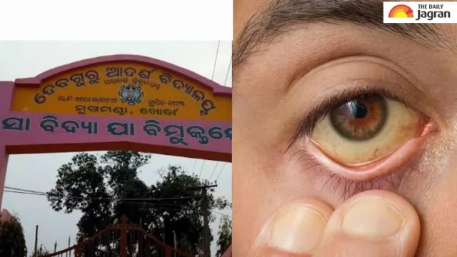 odisha-school-holiday-update-15day-closure-declares-following-jaundice-outbreak-in-khordha-district