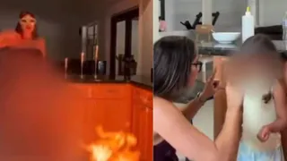 'Demonic And Evil’: Mother Drips Hot Wax On Daughters, Sets Kitchen Ablaze; Arrested As Video Goes Viral
