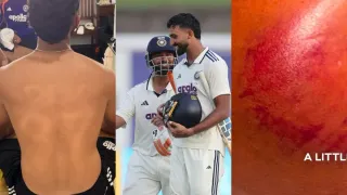 Devdutt Padikkal, Rishabh Pant Show Battle Scars After India’s Test Draw vs Sri Lanka