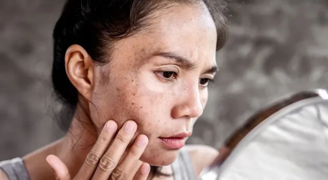 skin-care-mistakes-everyday-habits-that-could-be-secretly-damaging-your-skin
