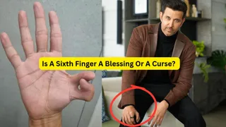 Born With Six Fingers? What Samudrik Shastra And Vedic Tradition Say